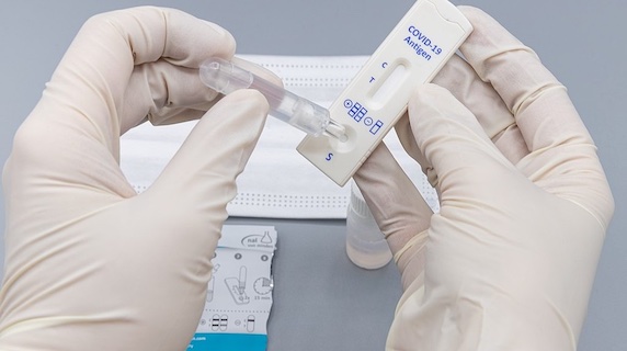 The Importance of Having the Antigen Rapid Test: When to Have It?